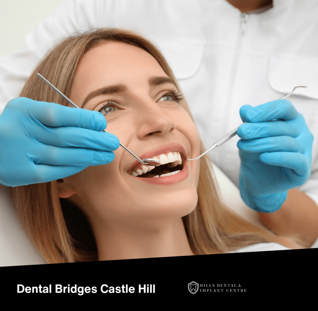 Dental Bridges Castle Hill