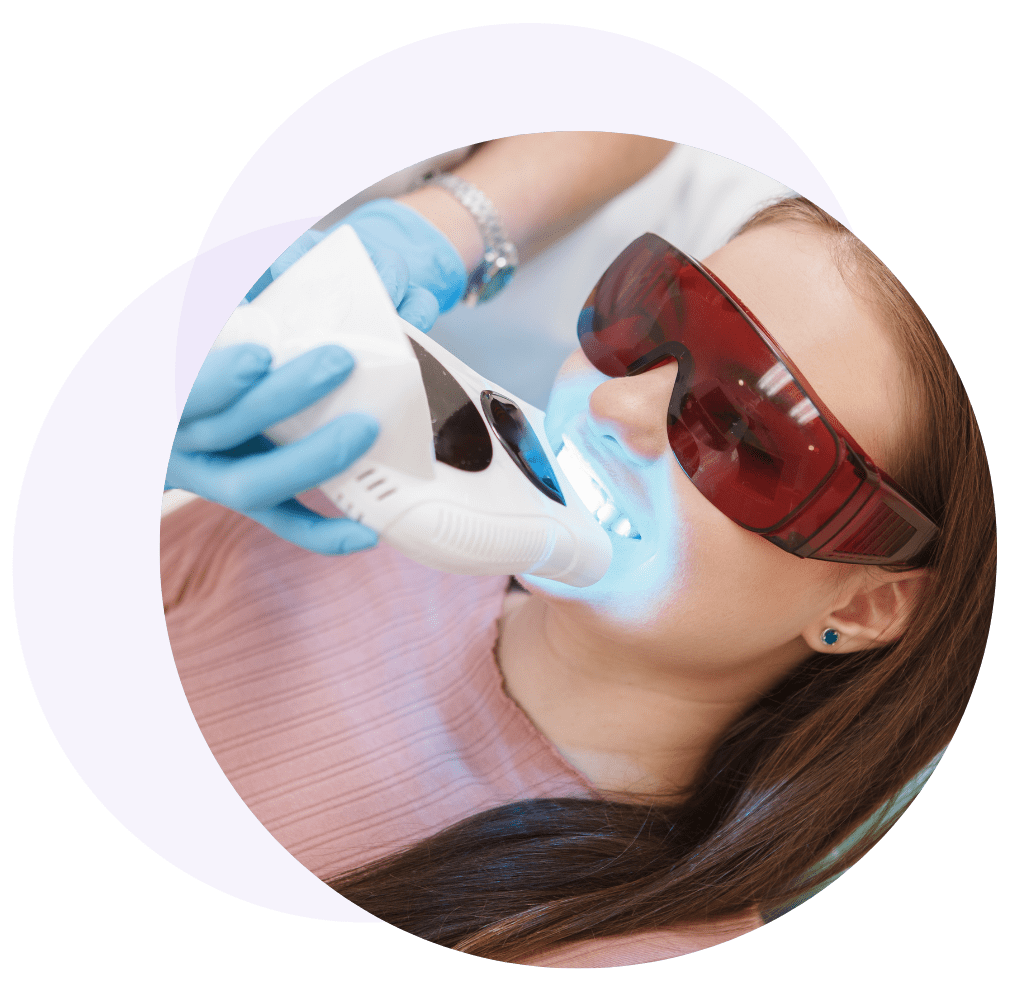 how does teeth whitening work How Does Teeth Whitening Work