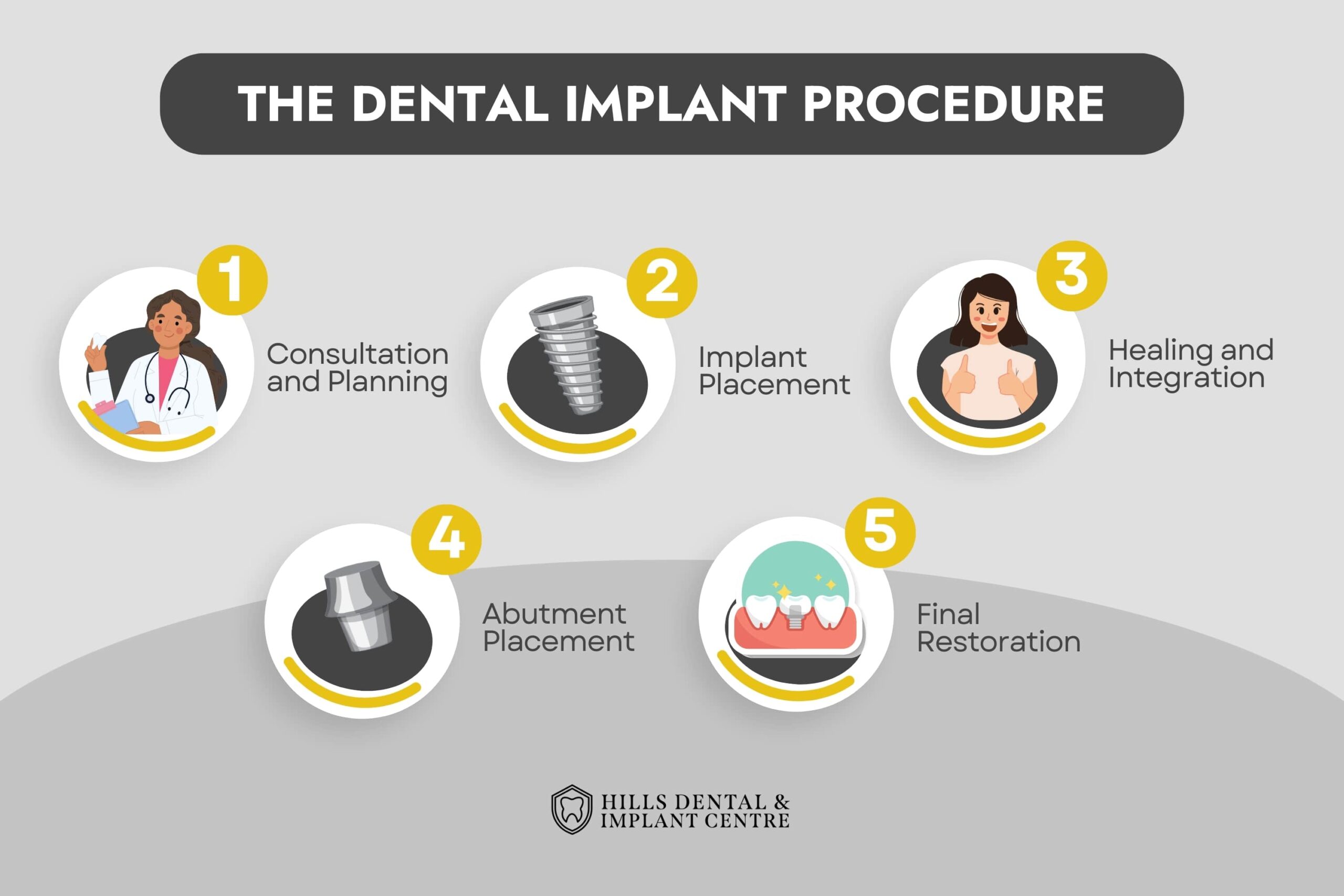 Implant placement procedure in Sydney