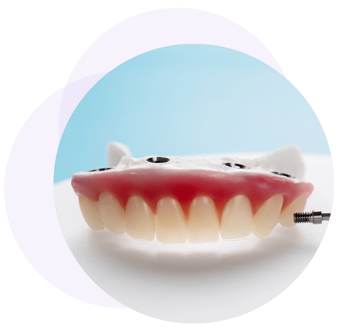 All on 4 - state-of-the-art Dental Procedure