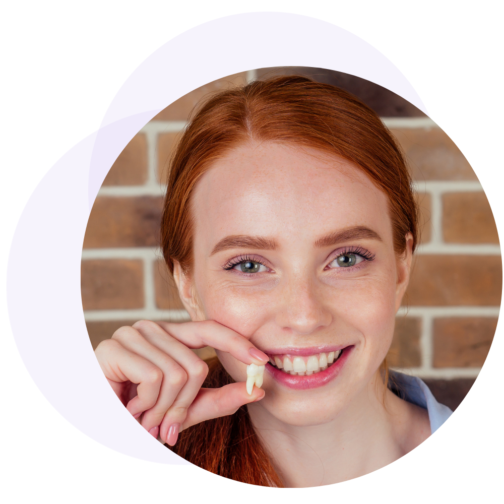 why remove wisdom teeth