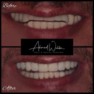 before after dental treatment