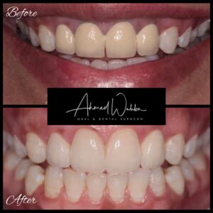 cosmetic dentistry results
