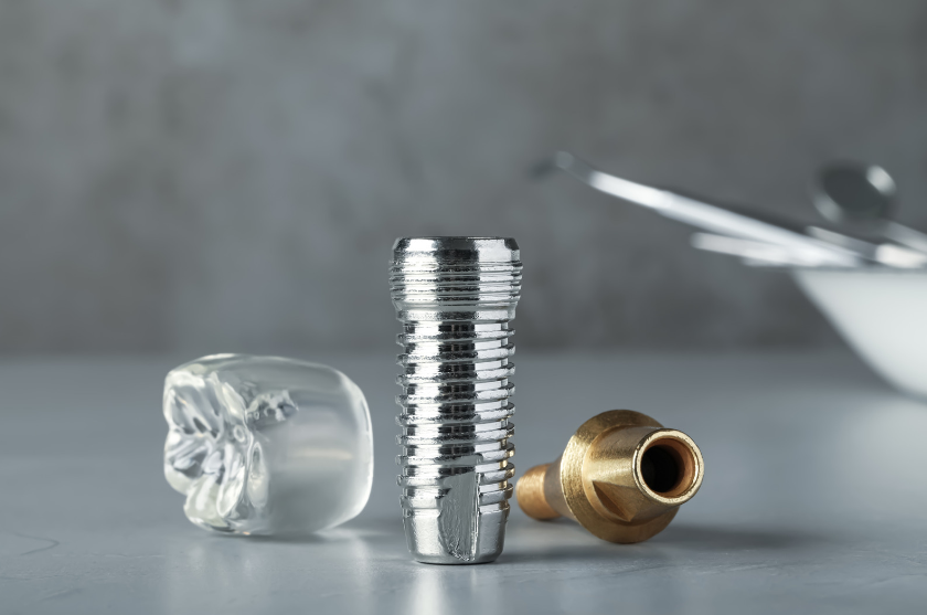 dental implantt 1